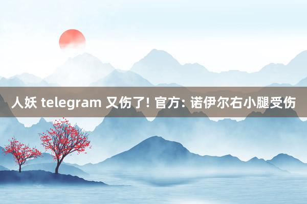 人妖 telegram 又伤了! 官方: 诺伊尔右小腿受伤